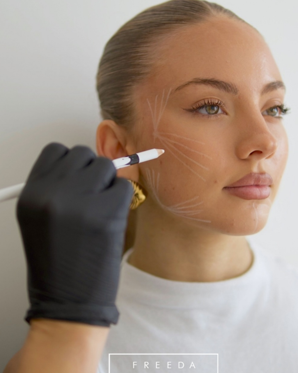 Discover Westbourne’s Specialist Skin, Laser and Aesthetics Clinics