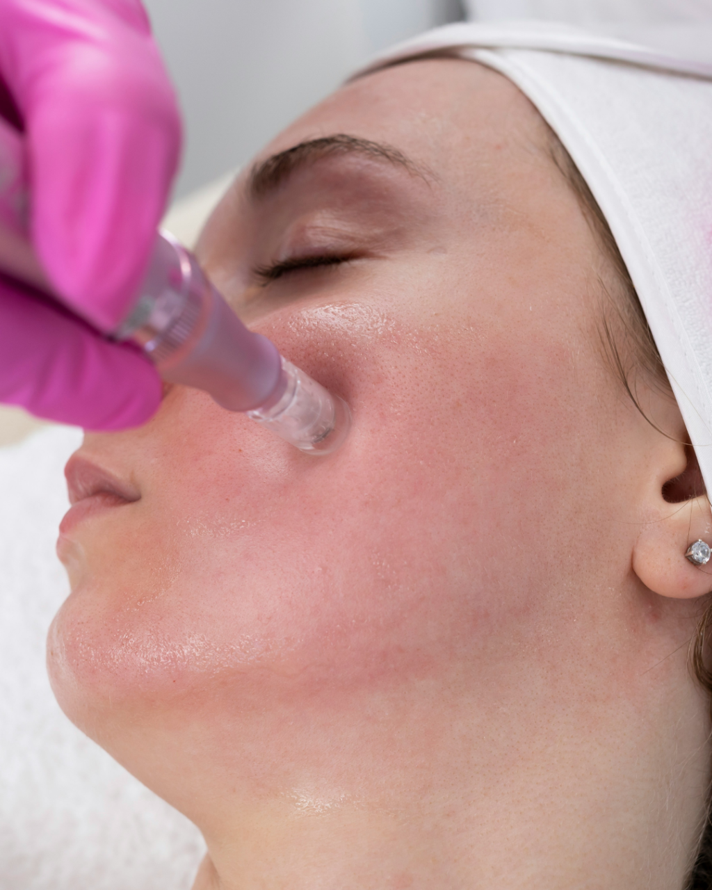 The Southbourne Skin Edit: Facials, Glow-Boosting Treatments & Local Skin Specialists