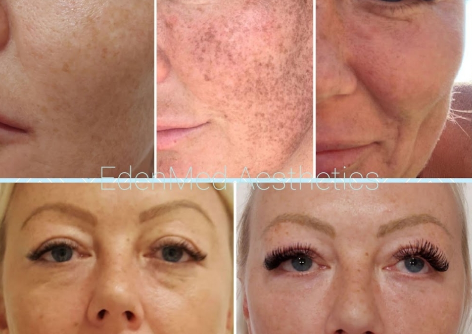 Compare Aesthetic Clinics and Beauty Treatments in Dorset